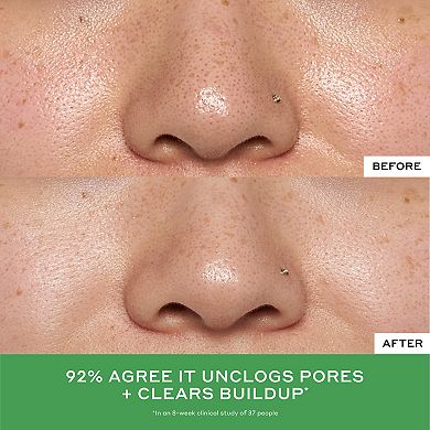 Detox Drops 2% Salicylic Acid Toner