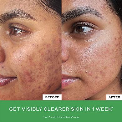 Daily D-Clog Pore-Clearing Salicylic Acid Cleanser