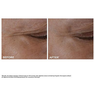 Total Eye Lift Eye Cream for Firming, Wrinkles, Dark Circles & Puffiness