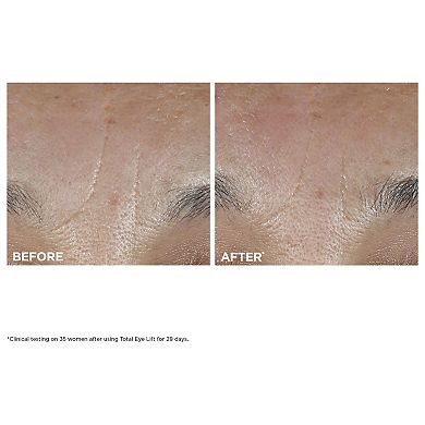 Total Eye Lift Eye Cream for Firming, Wrinkles, Dark Circles & Puffiness