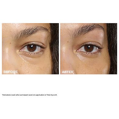 Total Eye Lift Eye Cream for Firming, Wrinkles, Dark Circles & Puffiness