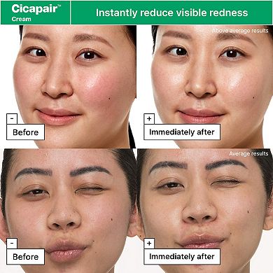 Cicapair Redness Rescue Regimen Kit with Centella Asiatica