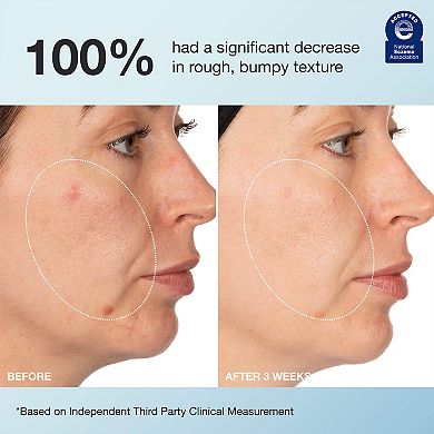 Recharge Gel Cream Smoothing & Plumping Moisturizer