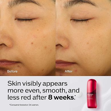 Ultimune Power Infusing Serum for Radiance & Wrinkles