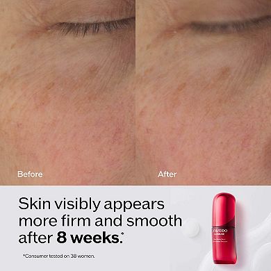 Ultimune Power Infusing Serum for Radiance & Wrinkles