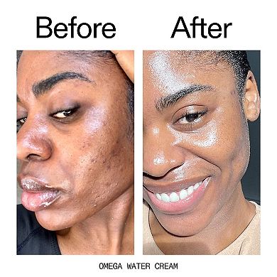 It's Giving Hydration Set