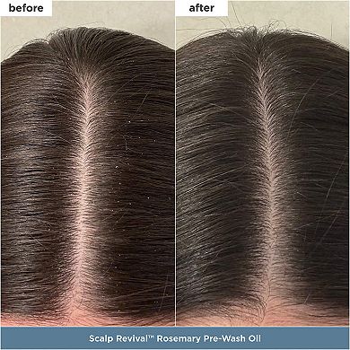 Healthy Hair Delights Gift Set for Scalp-to-Strand Care