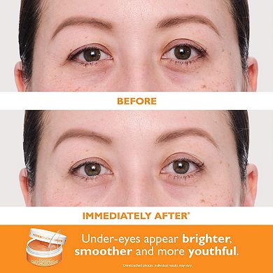 Full-Size Vitamin C & Hyaluronic Acid Eye Patches 2-Piece Gift Set