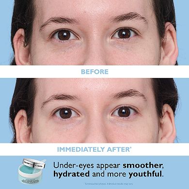 Patch + Go Eye Patch Travel Set for Hydrating & Firming