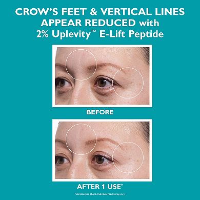 Full-Size Peptide Skinjection 2-Piece Skincare Set for Dark Circles