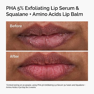 PHA 5% Exfoliating Lip Serum