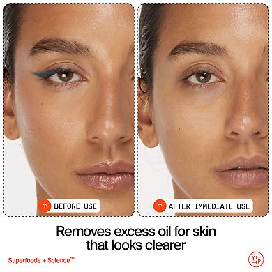 The Headliners Superfood Antioxidant Cleanser Skincare Set