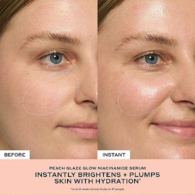 Get Glazed and Glowing Skincare Set