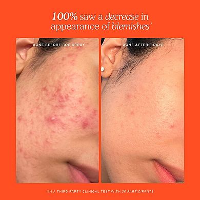 Mini SOS Skincare Bestsellers Set