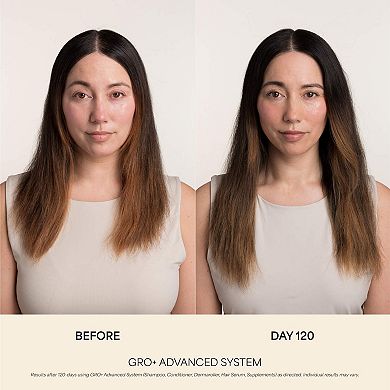 GRO+ Advanced Balancing Conditioner for Severe Signs of Thinning