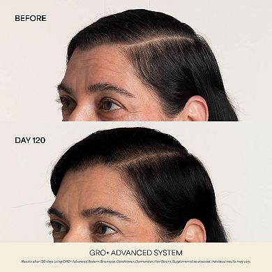 GRO+ Advanced Hair Serum for Severe Signs of Thinning