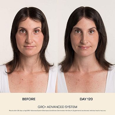 GRO+ Advanced Balancing Shampoo for Severe Signs of Thinning
