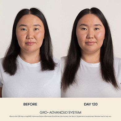 GRO+ Advanced Balancing Shampoo for Severe Signs of Thinning