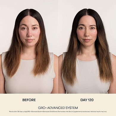 GRO+ Advanced Balancing Shampoo for Severe Signs of Thinning