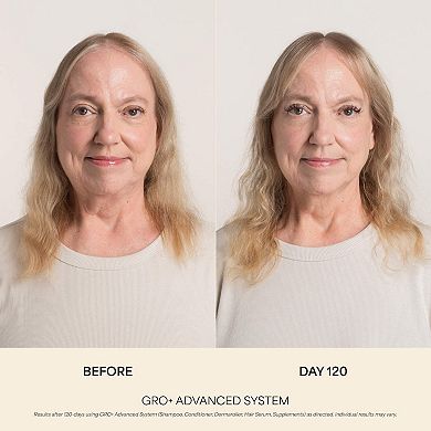 GRO+ Advanced Balancing Shampoo for Severe Signs of Thinning