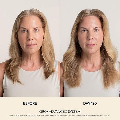 GRO+ Advanced Balancing Shampoo for Severe Signs of Thinning