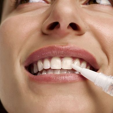 GlowPen: On-The-Go Whitening Pen