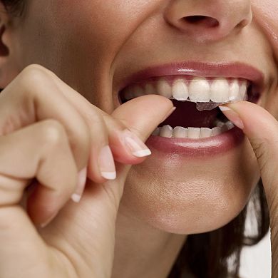 SparkleStrips: Intensive Whitening Strips