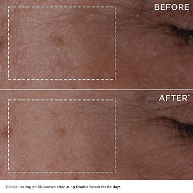 Double Serum Face & Eyes Anti-Aging Skincare Set