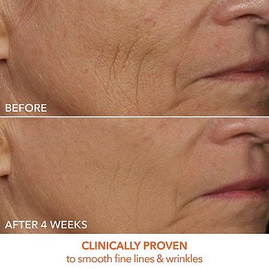 DRx SpectraLite FaceWare Pro 3-Minute LED Device