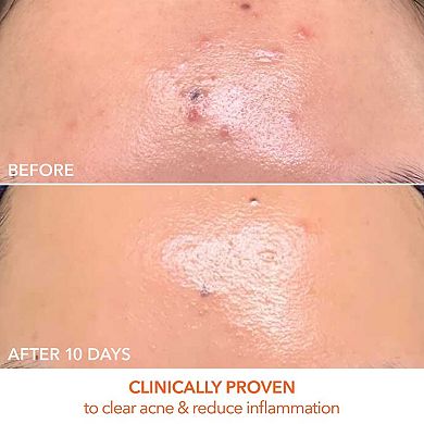 DRx SpectraLite FaceWare Pro 3-Minute LED Device