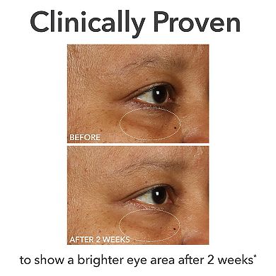 DermInfusions Fill + Repair Eye Cream