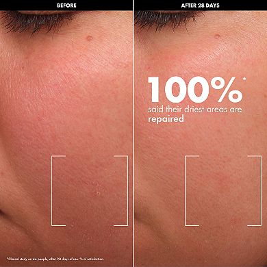 HYDRATE - Balmy Rich Cream with Lipids + Ceramides