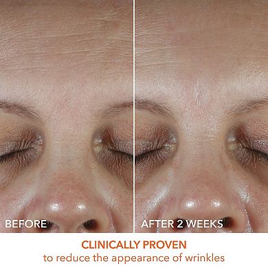 Vitamin C Lactic Oil-Free Radiant Moisturizer