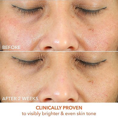 Vitamin C Lactic Oil-Free Radiant Moisturizer
