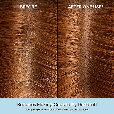 Scalp Revival Dandruff Relief Shampoo with Salicylic Acid