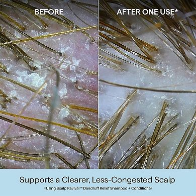 Scalp Revival Dandruff Relief Shampoo with Salicylic Acid