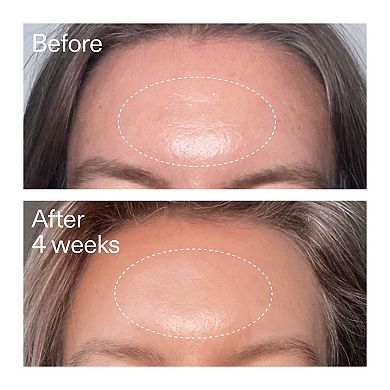 Advanced Retinal Serum for Fine lines + Wrinkles