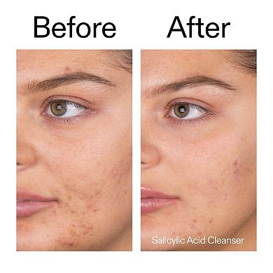 Target + Treat Breakouts Kit