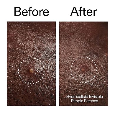 Target + Treat Breakouts Kit