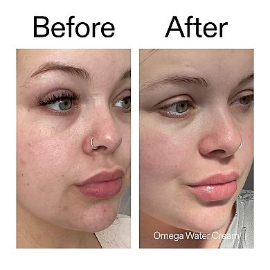 Daily Fresh Skin Fix Set