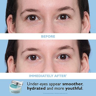 Full-Size Water Drench Hyaluronic Acid Essentials 2-Piece Moisturizer and Eye Patch Set
