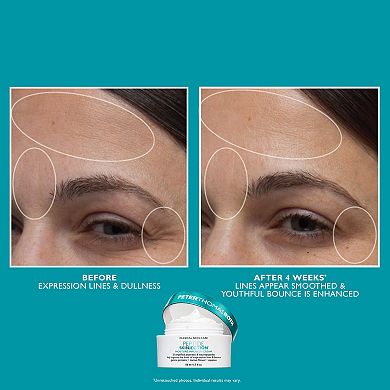 Full-Size Peptide Skinjection 2-Piece Skincare Set with Under-Eye Cream and Moisturizer