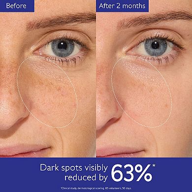 Vinoperfect Brightening Set for Dark Spots and Uneven Skin Tone