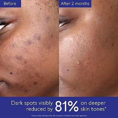 Vinoperfect Brightening Set for Dark Spots and Uneven Skin Tone