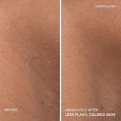 Green Tea Ceramide Cream for Redness & Barrier Repair