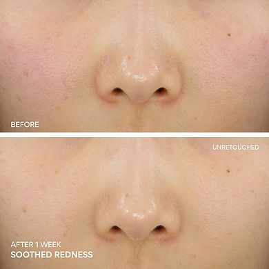 Green Tea Ceramide Cream for Redness & Barrier Repair