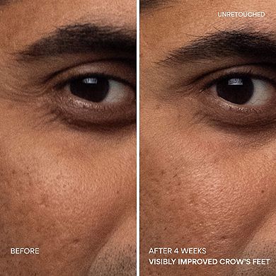 Green Tea PDRN Smoothing Eye & Lip Serum for Fine Lines + Wrinkles