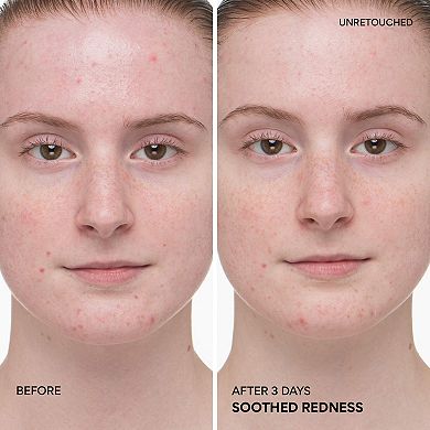 Green Tea Ceramide Milk Toner for Hydration & Barrier Repair