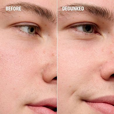 The POREfessional Degunker Blackhead & Pore Cleansing Mask System