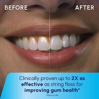 Waterpik Cordless 1000 Rechargeable Water Flosser